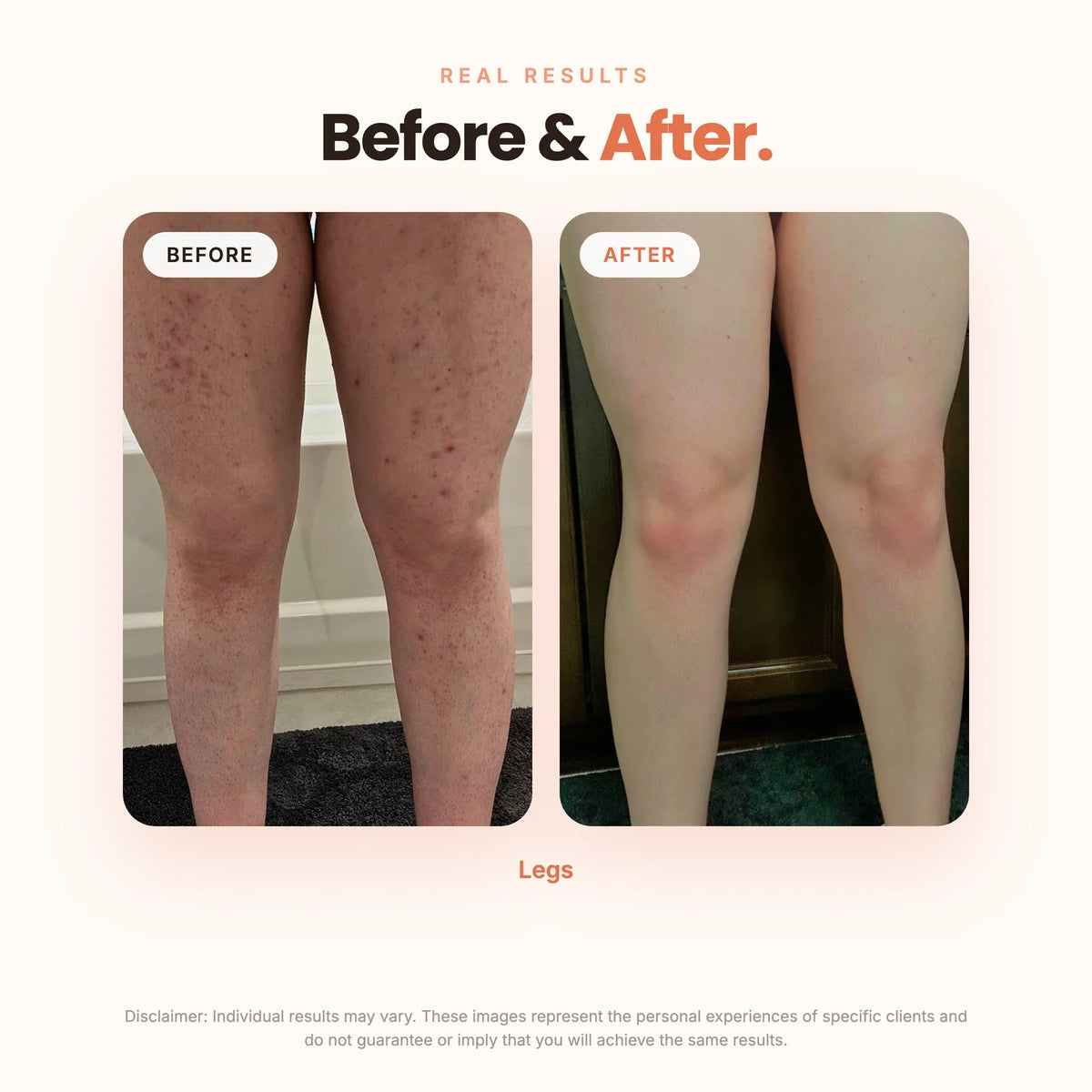 Bikini Line Smoothing & Brightening Serum