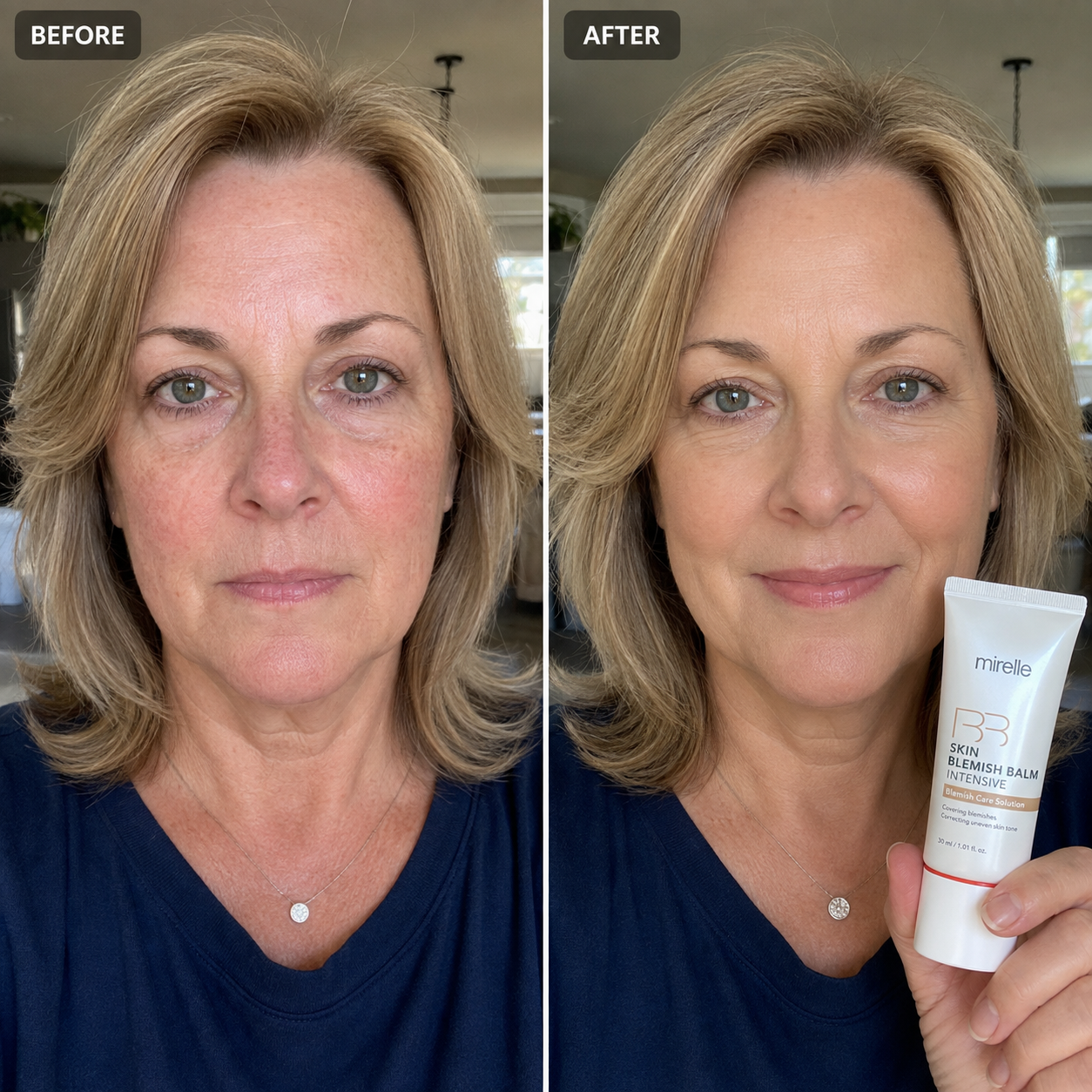 Korean Skin Blemish Balm Intensive