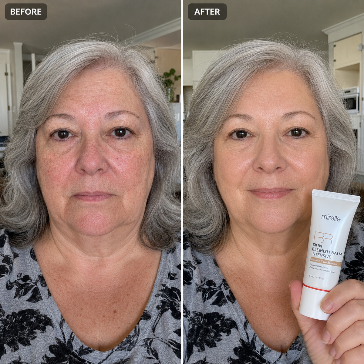Korean Skin Blemish Balm Intensive