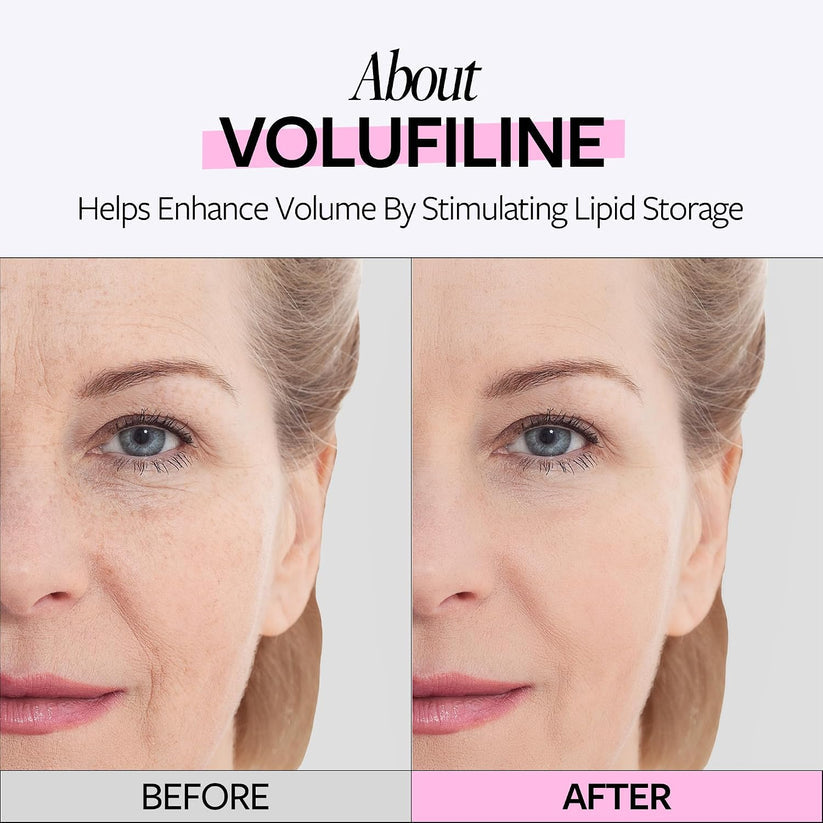 The #1 Rated 100% Volufiline — Plumping, Volume & Anti-Hollow Recovery